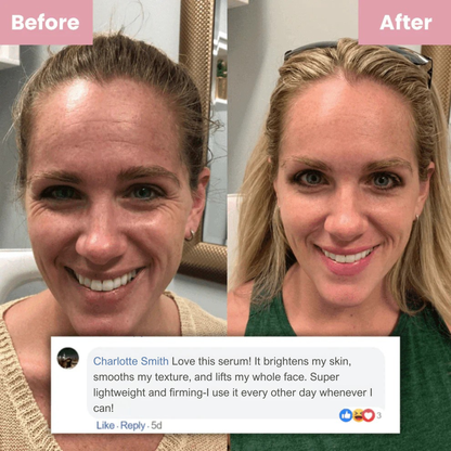 Bakuchiol Youth Renewal Serum