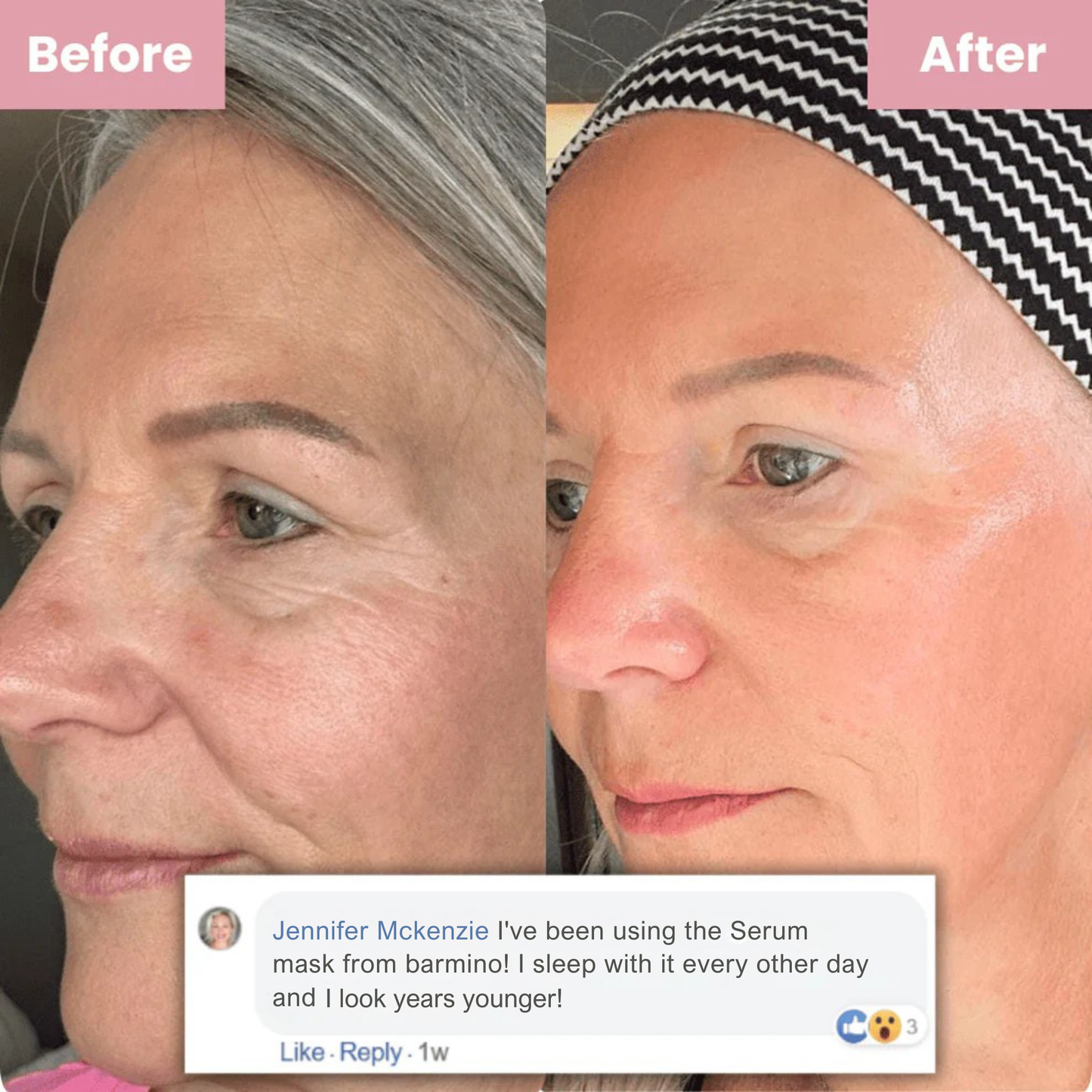 Bakuchiol Youth Renewal Serum