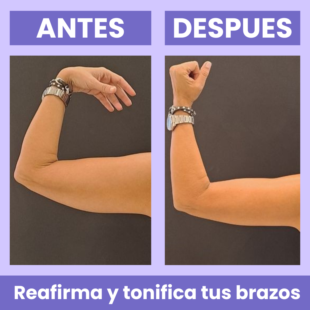 Barmino® Esculpe y Tonifica Brazos Flacidos en Semanas
