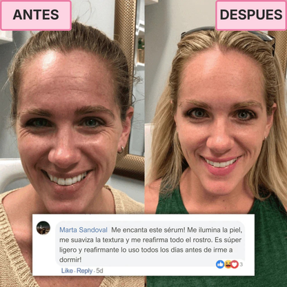 Tratamiento Coreano de Colágeno