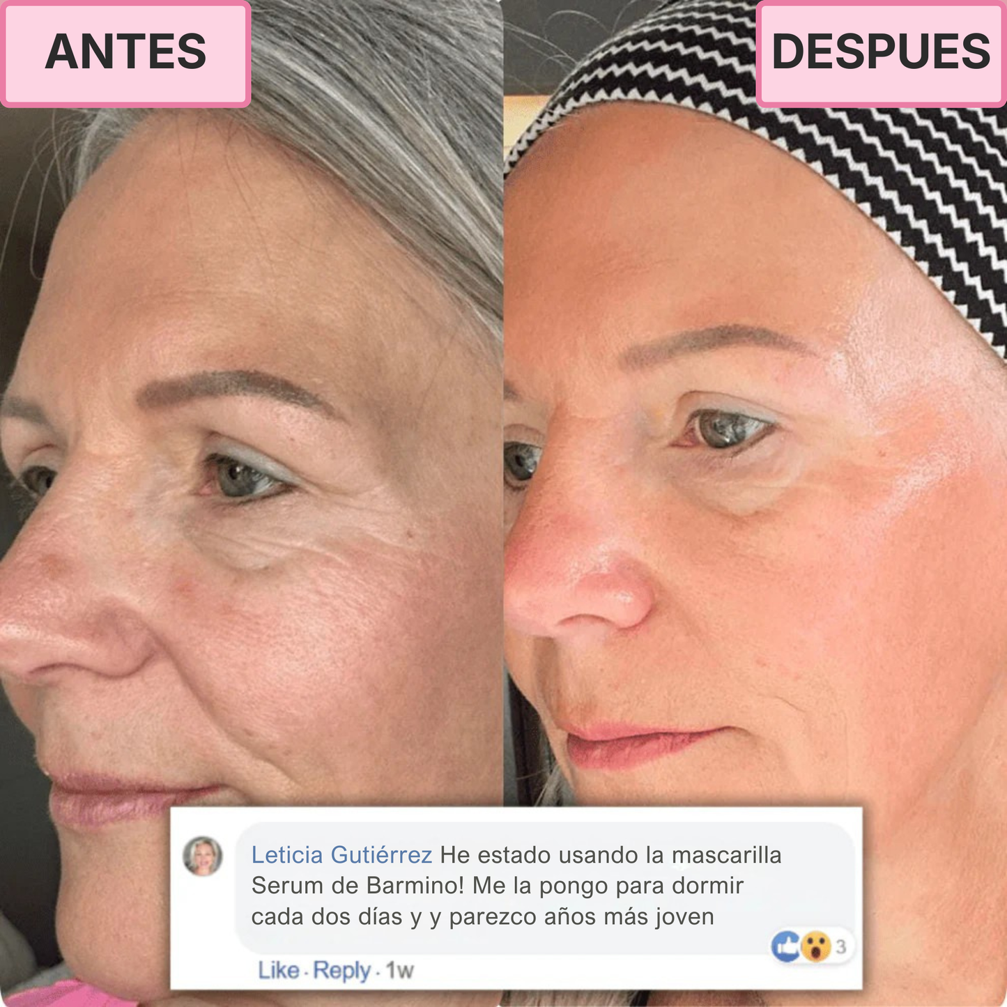 Tratamiento Coreano de Colágeno