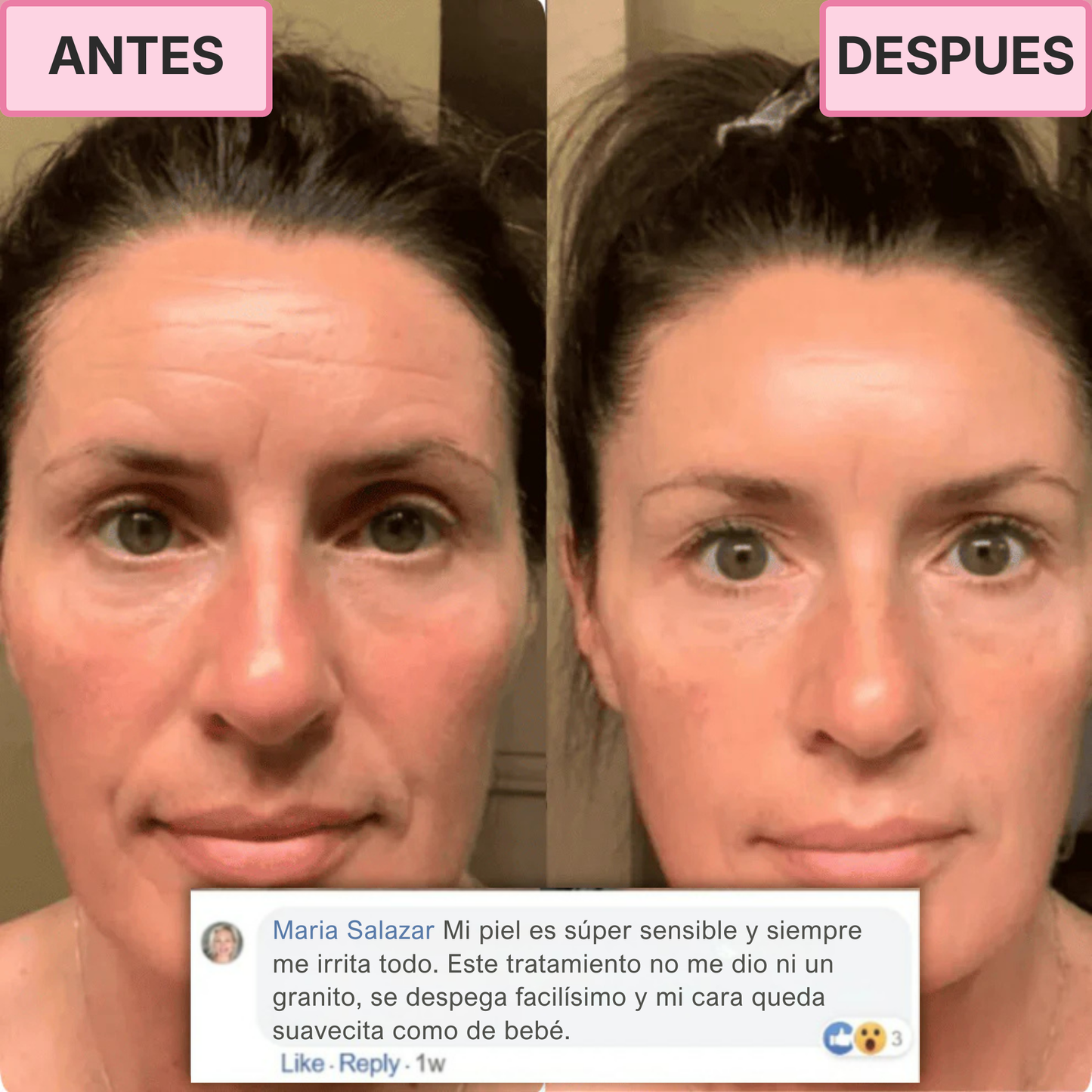 Tratamiento Coreano de Colágeno