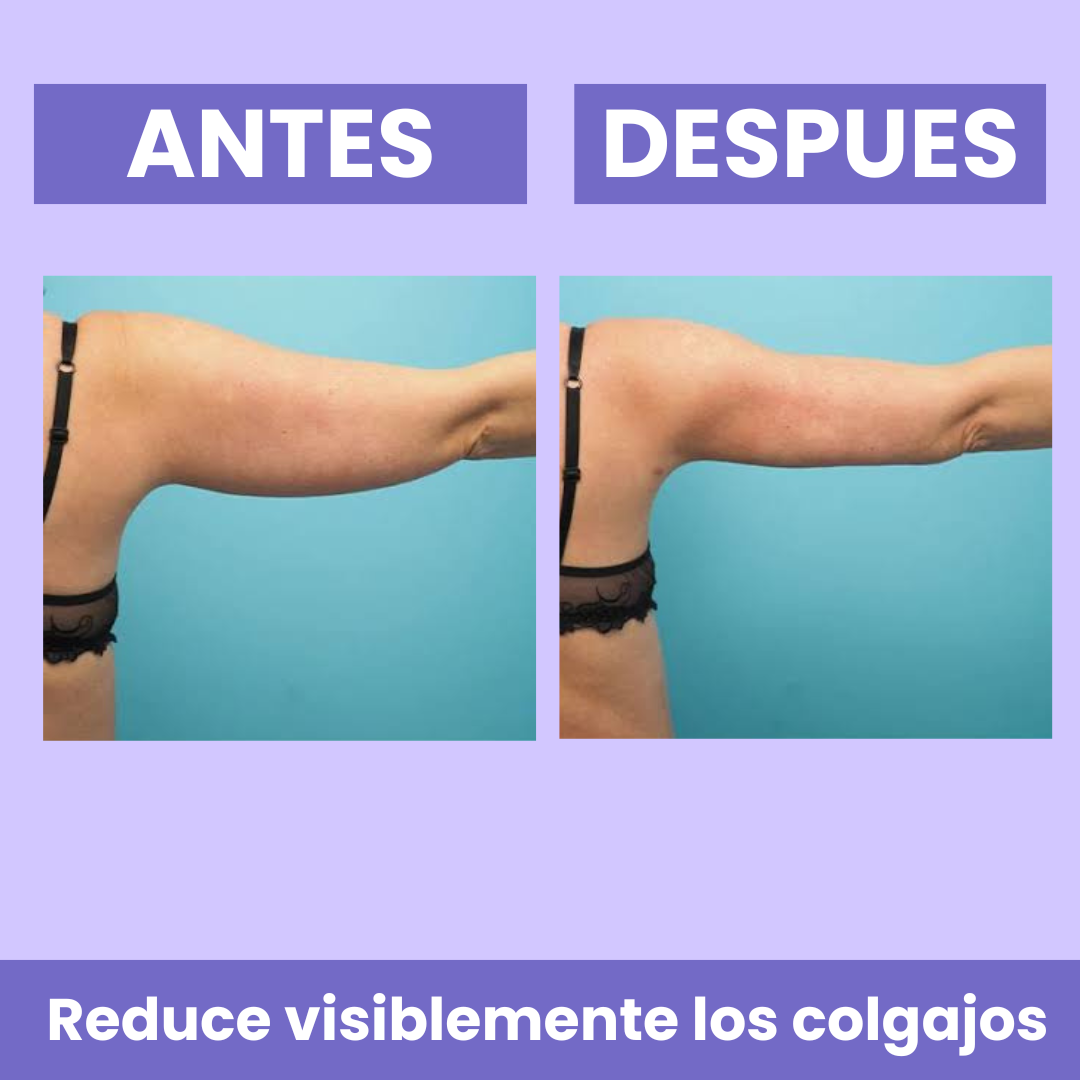 Barmino® Esculpe y Tonifica Brazos Flacidos en Semanas