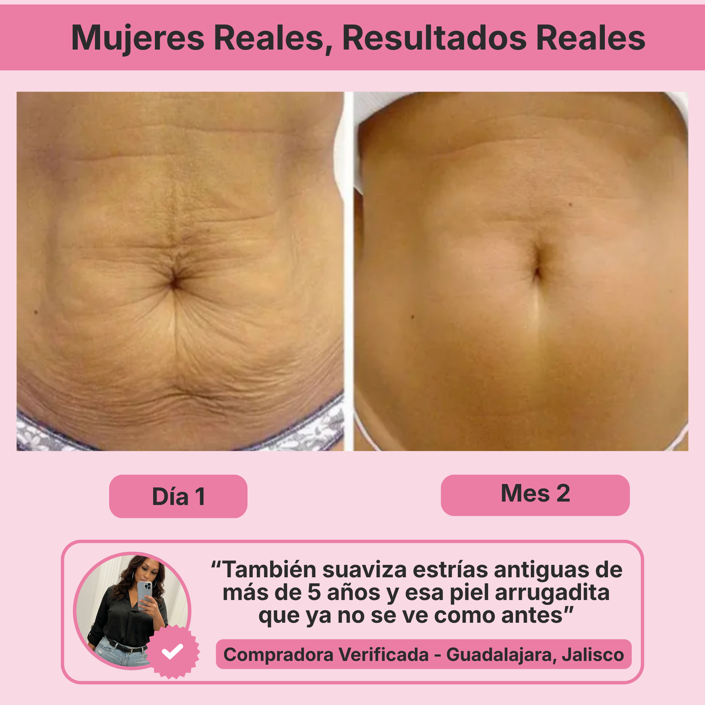 (5 Meses - Panza, Muslos y Busto) Tratamiento Barmino® Personalizado Antiestrias y Flacidez Postparto + Guia Masaje Drenante para Grasa Abdominal + Potenciador Dermico Resultados 3X Más Rápido + Acceso Comunidad Mamás Barmino