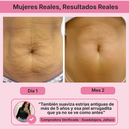 (5 Meses - Panza, Muslos y Busto) Tratamiento Barmino® Personalizado Antiestrias y Flacidez Postparto + Guia Masaje Drenante para Grasa Abdominal + Potenciador Dermico Resultados 3X Más Rápido + Acceso Comunidad Mamás Barmino