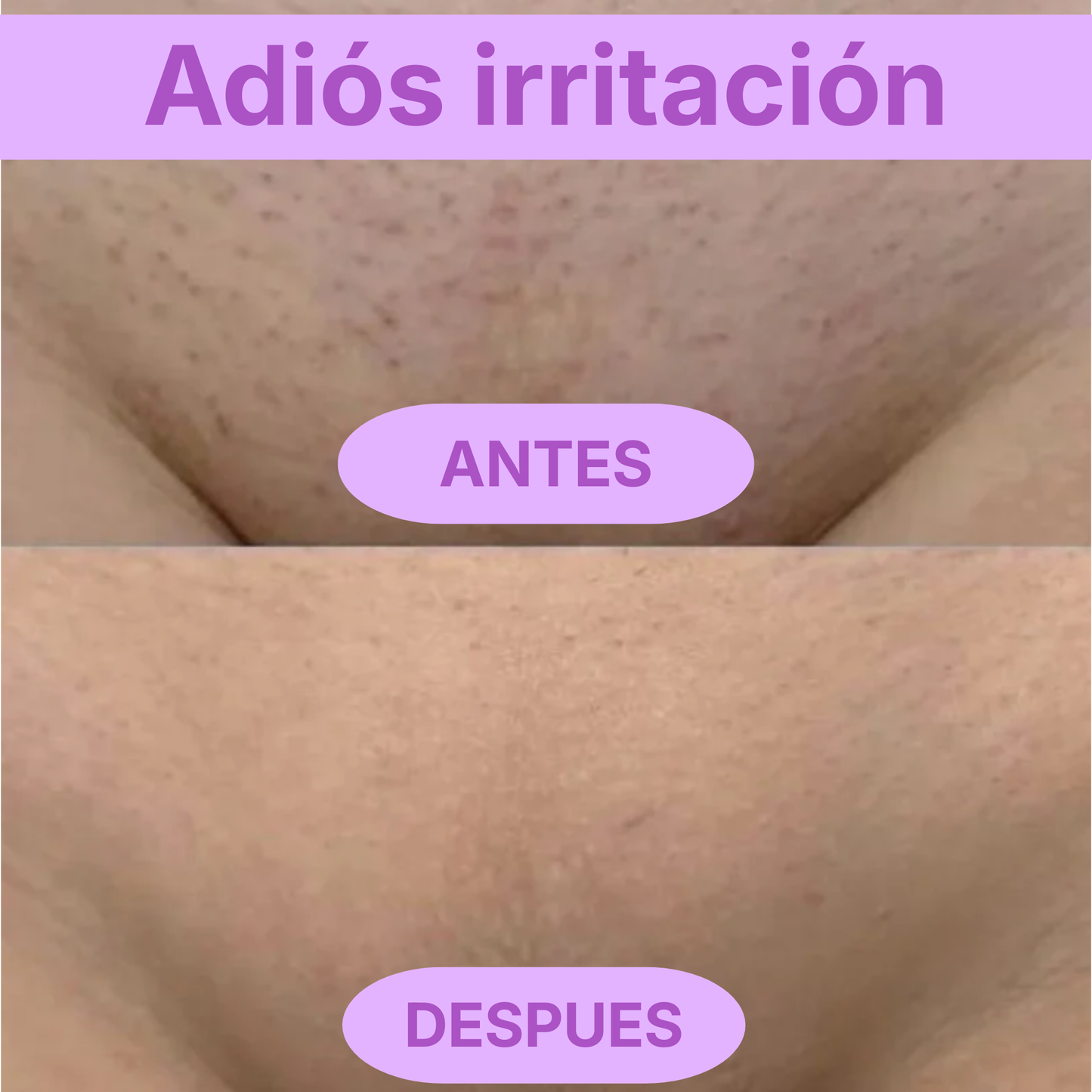 Rasuradora Barmino Bikini Triki®  — Sin granitos, sin irritación.