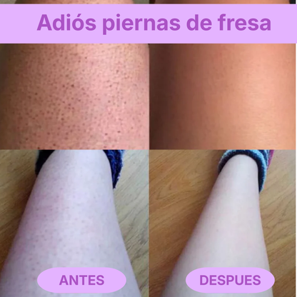 Rasuradora Barmino Bikini Triki®  — Sin granitos, sin irritación.