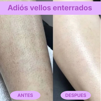 Rasuradora Barmino Bikini Triki®  — Sin granitos, sin irritación.